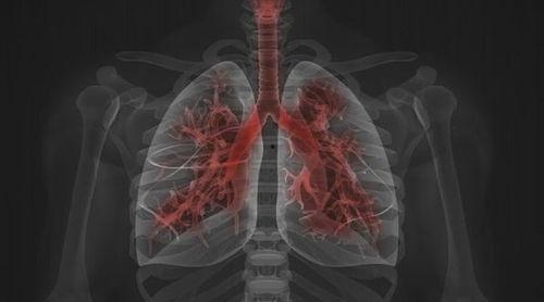 人皮蝇感染的视频,揭秘恐怖虫害的生存与传播